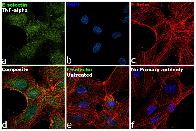 E-selectin Antibody in Immunocytochemistry (ICC/IF)