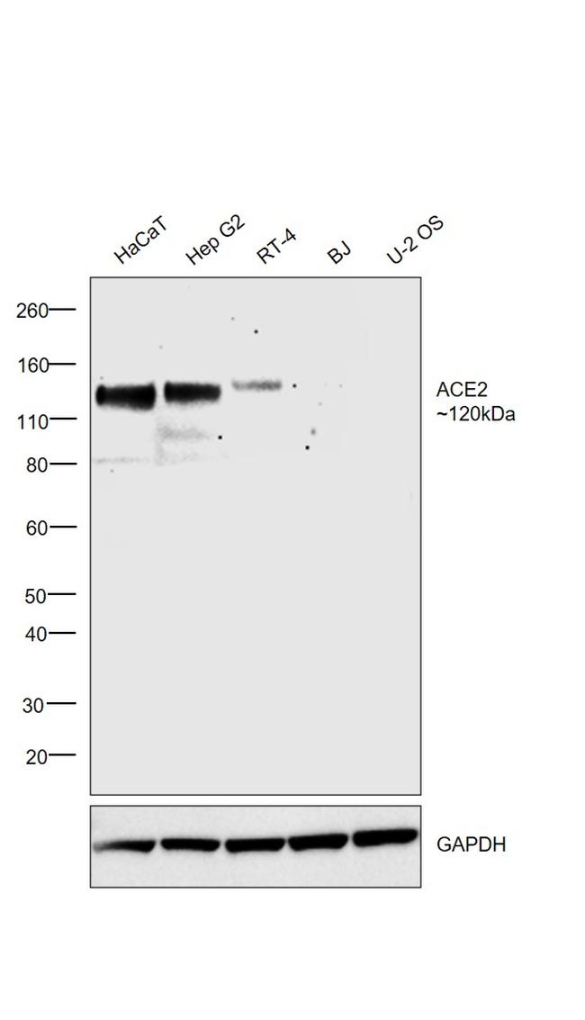 ACE2 Antibody in Western Blot (WB)