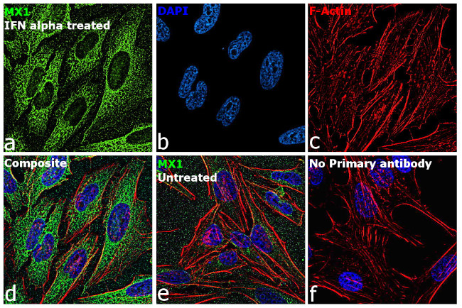 MX1 Antibody in Immunocytochemistry (ICC/IF)