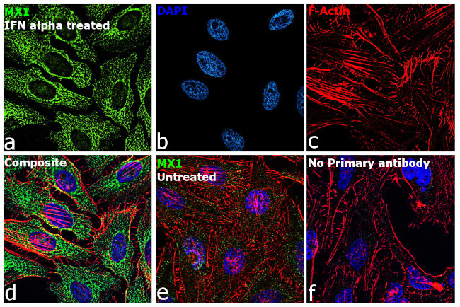 MX1 Antibody in Immunocytochemistry (ICC/IF)