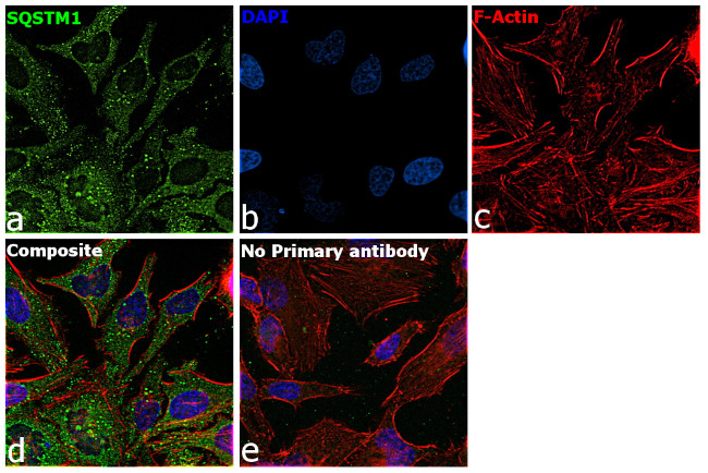 SQSTM1 Antibody in Immunocytochemistry (ICC/IF)