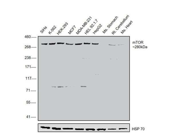 mTOR Antibody in Western Blot (WB)