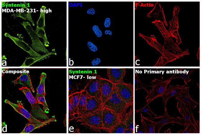 Syntenin 1 Antibody in Immunocytochemistry (ICC/IF)