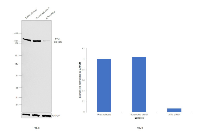 ATM Antibody