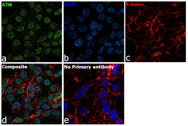 ATM Antibody in Immunocytochemistry (ICC/IF)