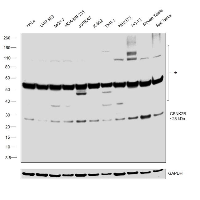 CK2 beta Antibody in Western Blot (WB)