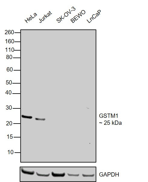 GSTM1 Antibody