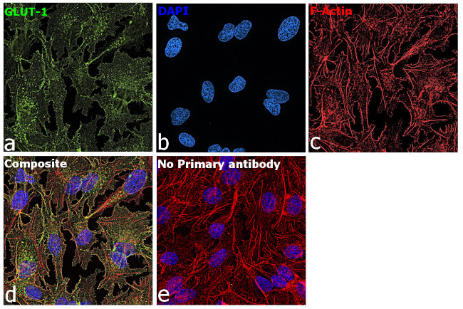 GLUT1 Antibody in Immunocytochemistry (ICC/IF)