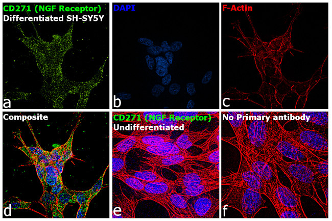 CD271 (NGF Receptor) Antibody in Immunocytochemistry (ICC/IF)