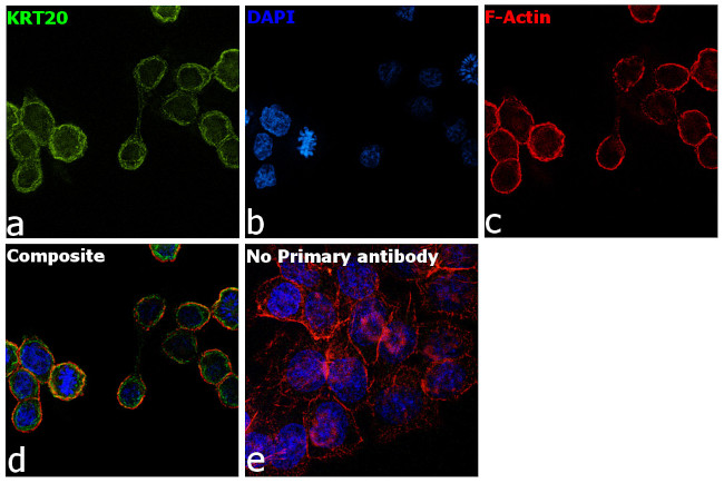 Cytokeratin 20 Antibody in Immunocytochemistry (ICC/IF)