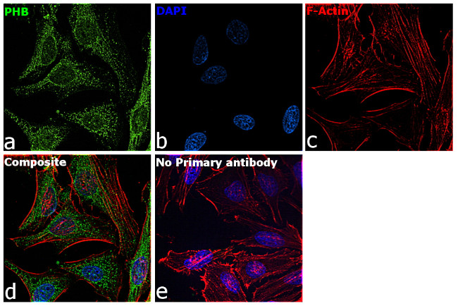 Prohibitin Antibody in Immunocytochemistry (ICC/IF)