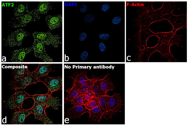 ATF2 Antibody in Immunocytochemistry (ICC/IF)