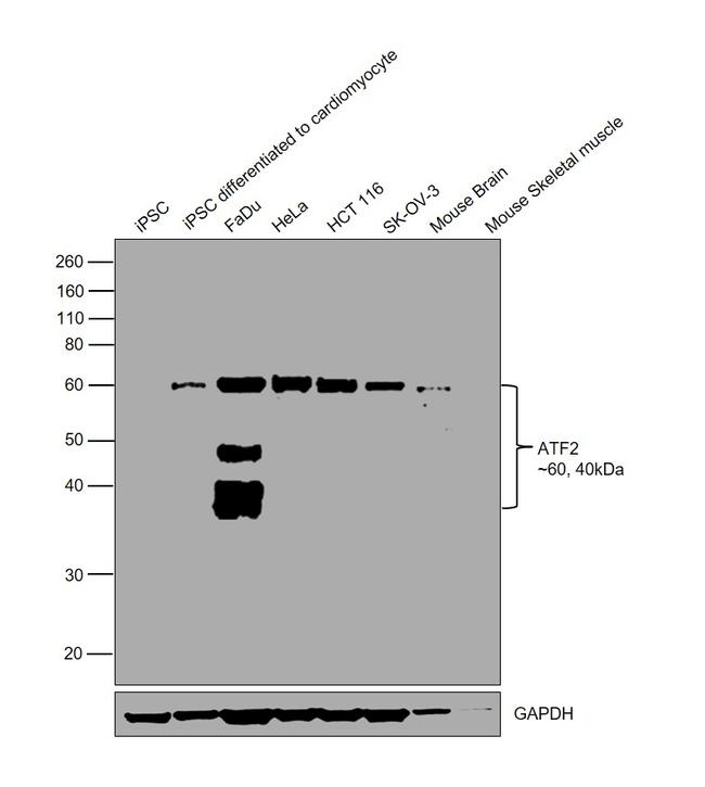 ATF2 Antibody in Western Blot (WB)