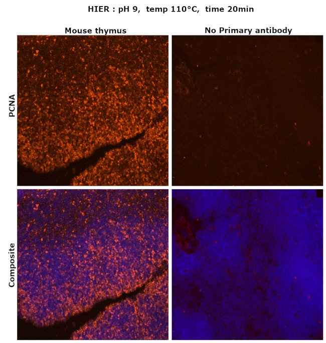 PCNA Antibody in Immunohistochemistry (Paraffin) (IHC (P))