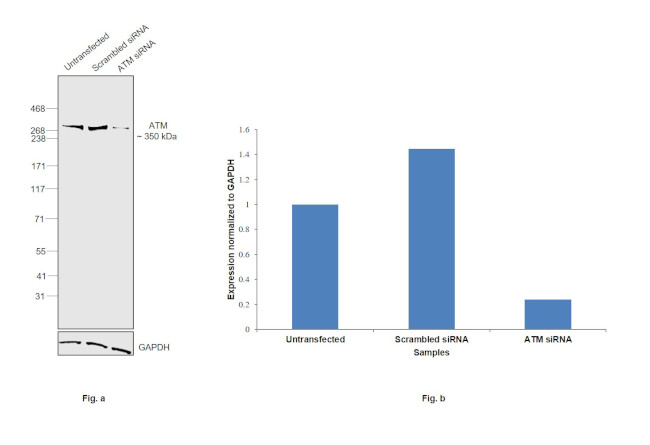 ATM Antibody