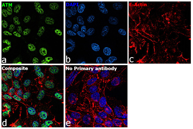 ATM Antibody in Immunocytochemistry (ICC/IF)