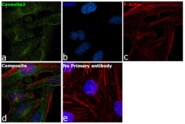 Caveolin 2 Antibody in Immunocytochemistry (ICC/IF)