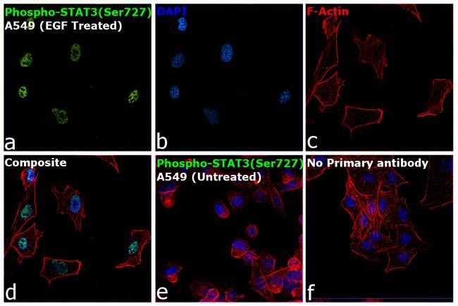 Phospho-STAT3 (Ser727) Antibody