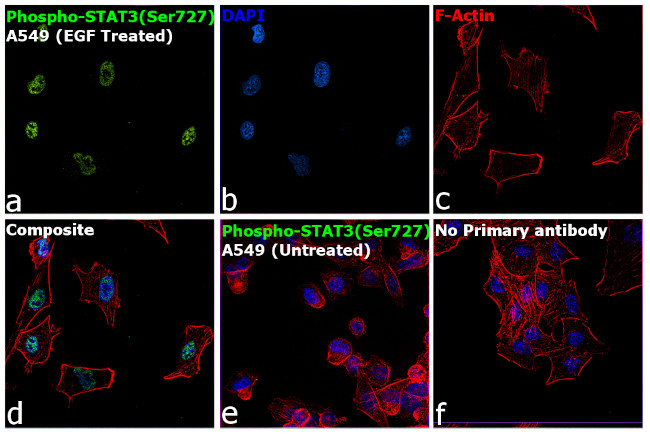 Phospho-STAT3 (Ser727) Antibody in Immunocytochemistry (ICC/IF)