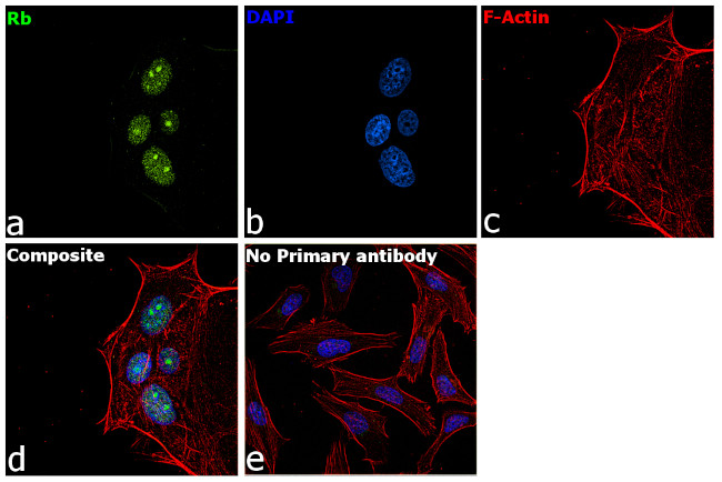 Rb Antibody in Immunocytochemistry (ICC/IF)