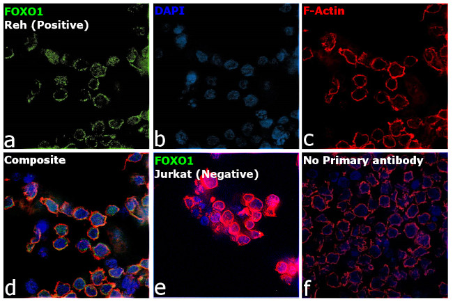 FOXO1 Antibody in Immunocytochemistry (ICC/IF)