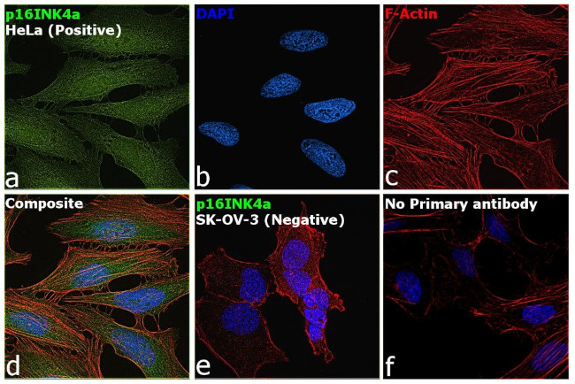 p16INK4a Antibody