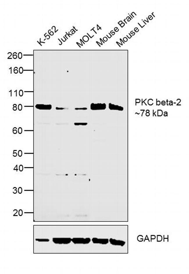 PKC beta-2 Antibody in Western Blot (WB)