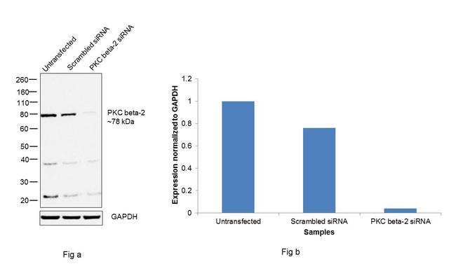 PKC beta-2 Antibody in Western Blot (WB)