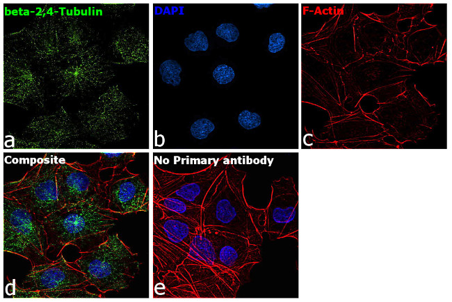 beta Tubulin 2,4 Antibody in Immunocytochemistry (ICC/IF)