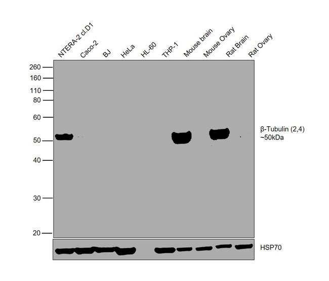 beta Tubulin 2,4 Antibody in Western Blot (WB)