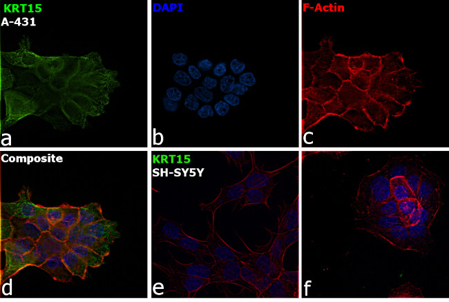 Cytokeratin 15 Antibody