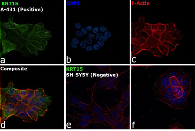 Cytokeratin 15 Antibody in Immunocytochemistry (ICC/IF)