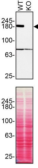 TSC2 Antibody