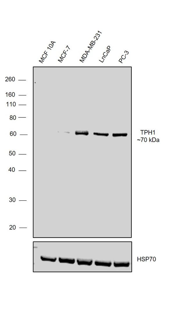 TPH1 Antibody in Western Blot (WB)