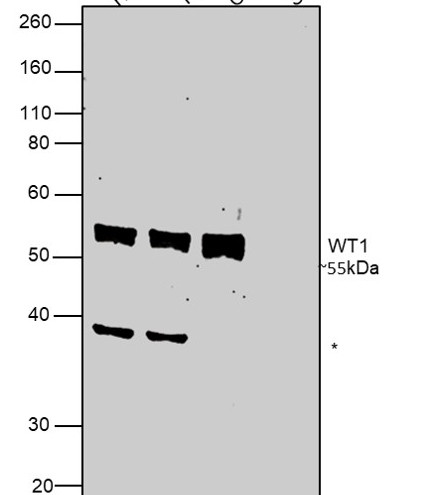 WT1 Antibody