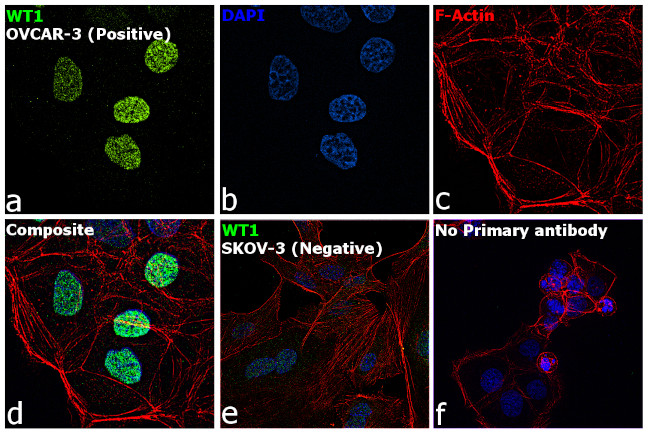 WT1 Antibody in Immunocytochemistry (ICC/IF)