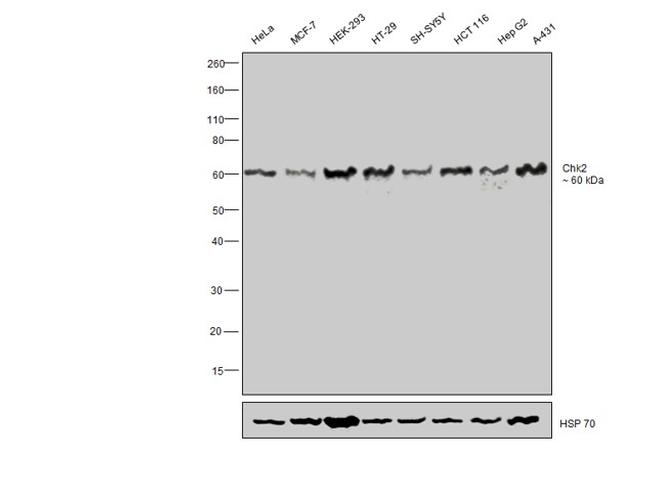 CHK2 Antibody in Western Blot (WB)