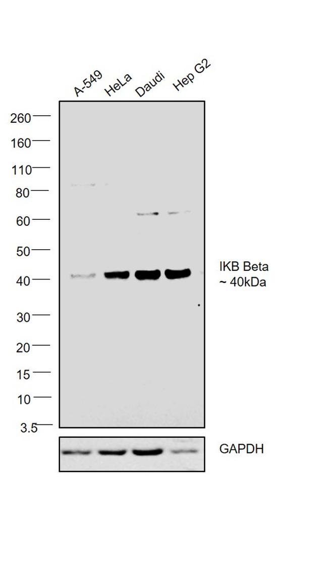 IkB beta Antibody in Western Blot (WB)