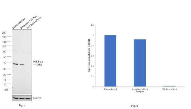 IkB beta Antibody