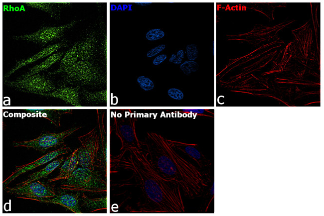 RhoA Antibody in Immunocytochemistry (ICC/IF)