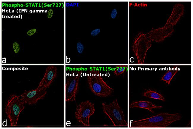 Phospho-STAT1 (Ser727) Antibody