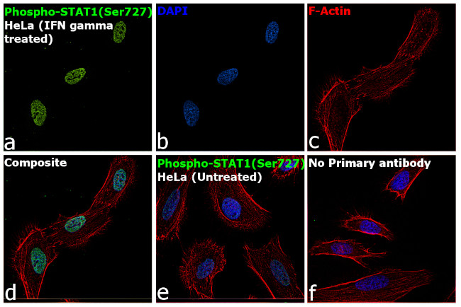 Phospho-STAT1 (Ser727) Antibody in Immunocytochemistry (ICC/IF)