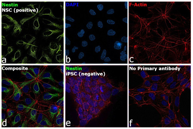 Nestin Antibody in Immunocytochemistry (ICC/IF)