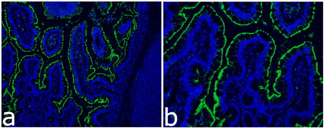 ACE2 Antibody in Immunocytochemistry (ICC/IF)