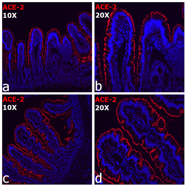 ACE2 Antibody in Immunocytochemistry (ICC/IF)