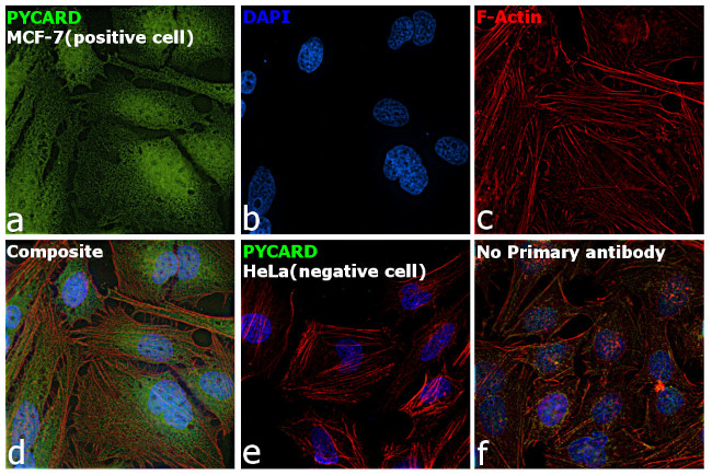 PYCARD Antibody in Immunocytochemistry (ICC/IF)