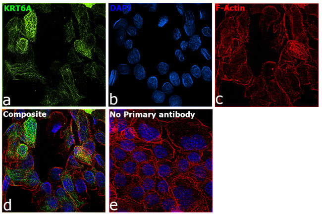 Cytokeratin 6 Antibody in Immunocytochemistry (ICC/IF)