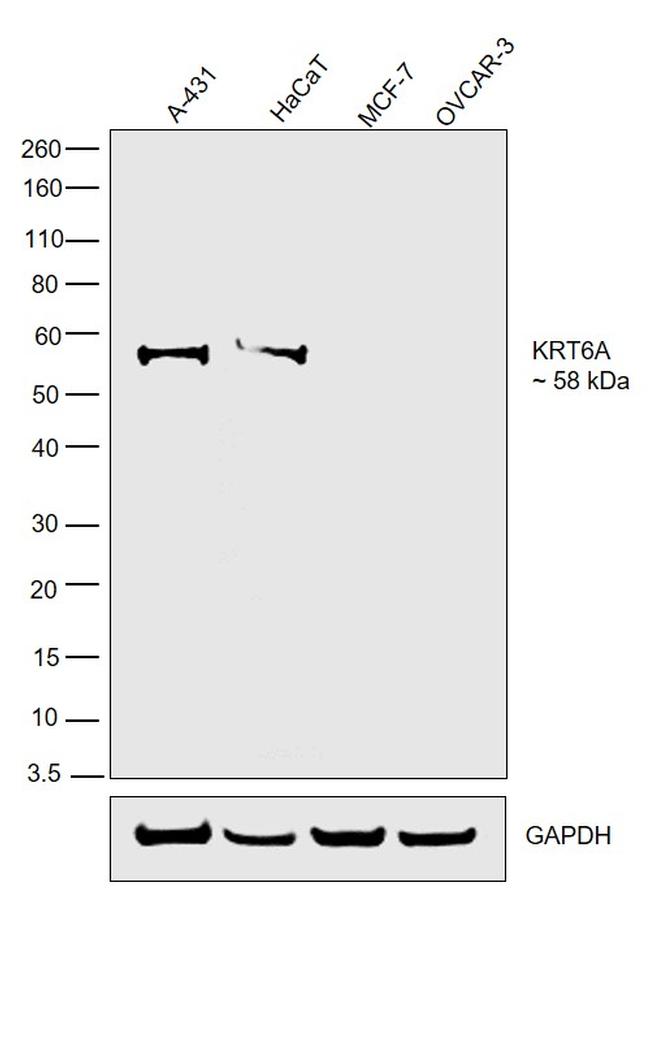 Cytokeratin 6 Antibody in Western Blot (WB)