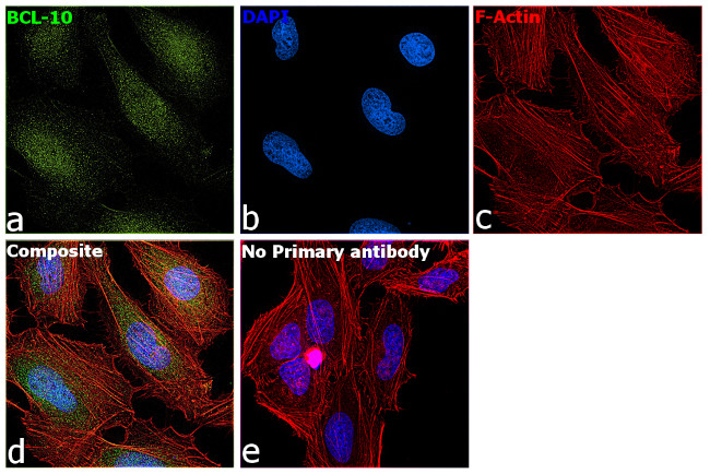 Bcl-10 Antibody in Immunocytochemistry (ICC/IF)