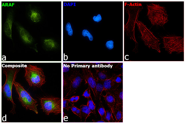 A-Raf Antibody in Immunocytochemistry (ICC/IF)